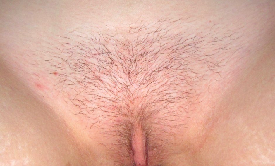 Hairs on women's pubis