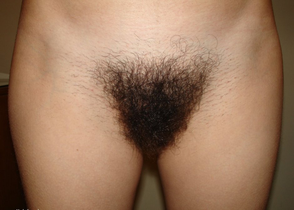 Very hairy female pubis