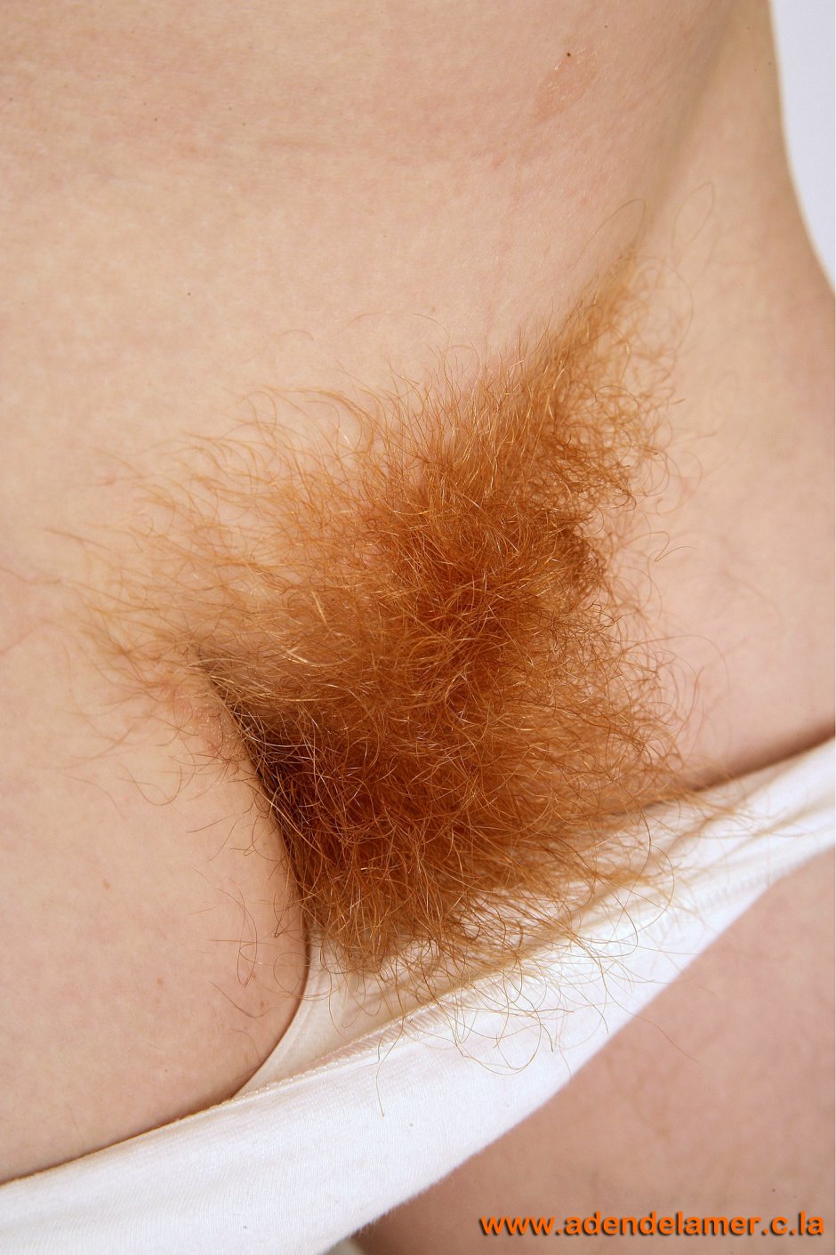 The most hairy female pubis