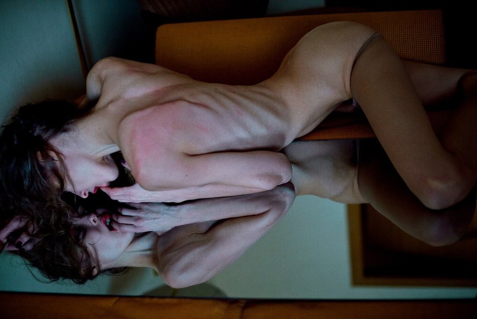 Naked skinny anorexics