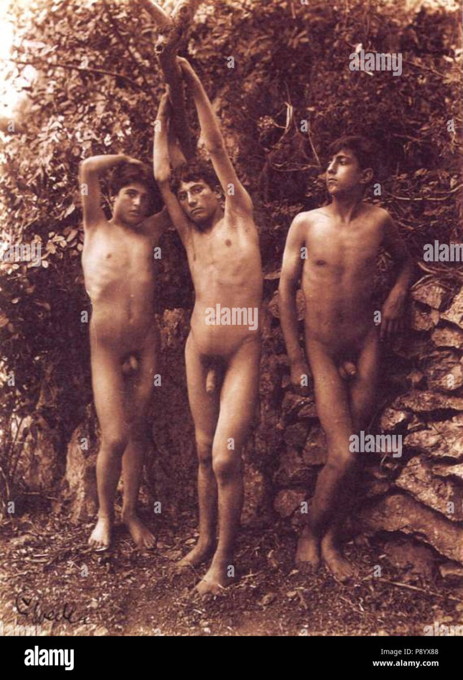 Von Galedic photographs of the genitals Group