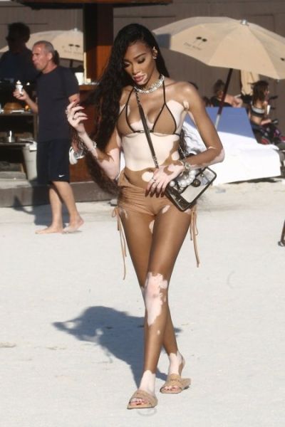 Winnie Harlow Ass