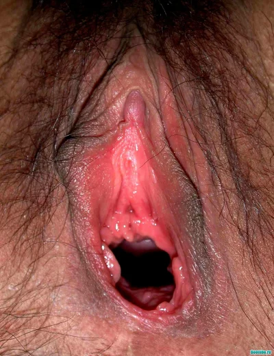 Выделение из влагалища