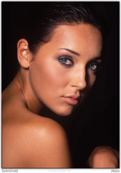 Певица алсу до пластики