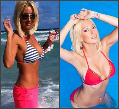 Лера кудрявцева в молодости до пластики