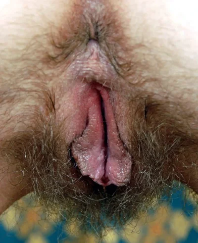 Лобковые волосы