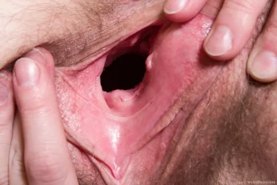 Здоровая шейка матки