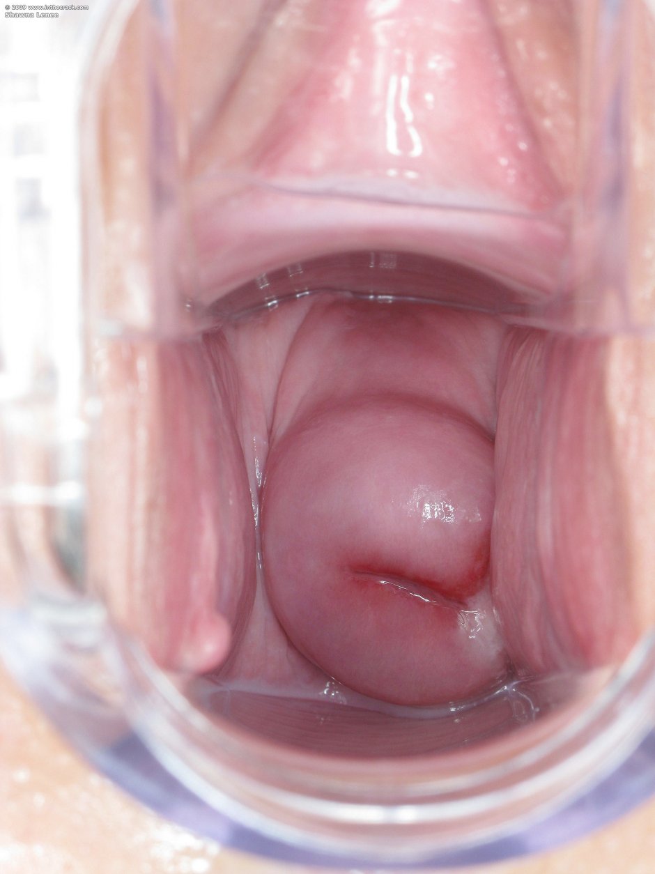 Здоровая шейка матки