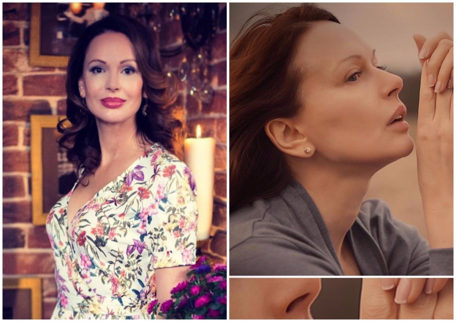 Ирина безрукова пластика