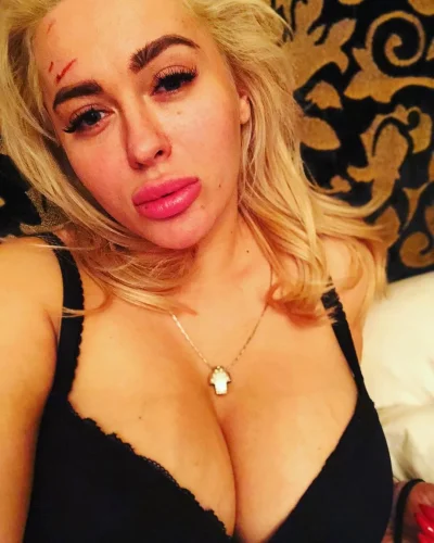 Мария кохно после пластики