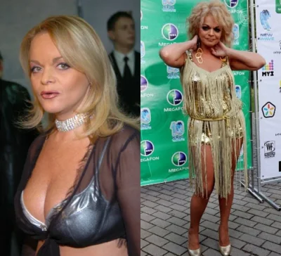 Лариса долина грудь