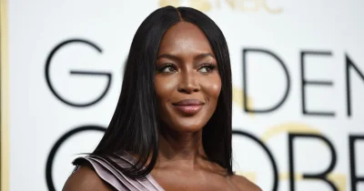 Наоми кэмпбелл после пластики