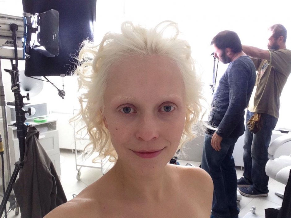 Модель альбинос алиса лисс