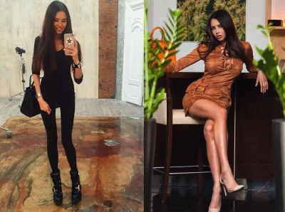 Анастасия решетова до пластики