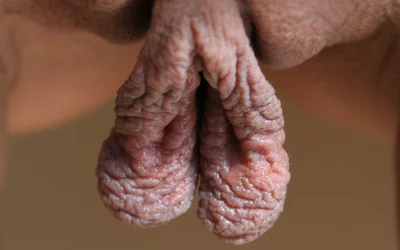 Огромные половые губы