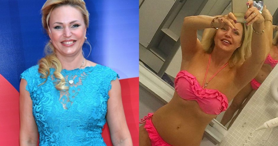 Алла довлатова до и после пластики