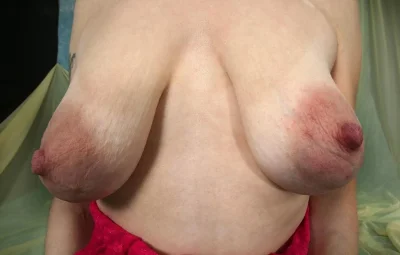 Большая обвисшая грудь