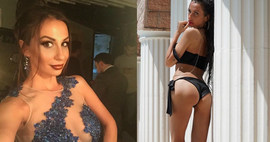 Анна грачевская до и после пластики