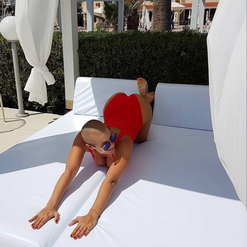 Лысая девушка