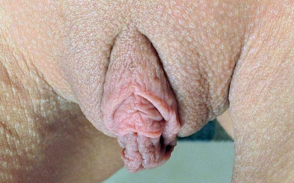 Порода шарпей