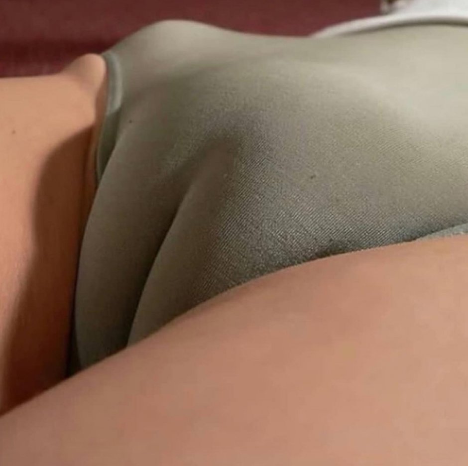 Верблюжья лапа у толстушек