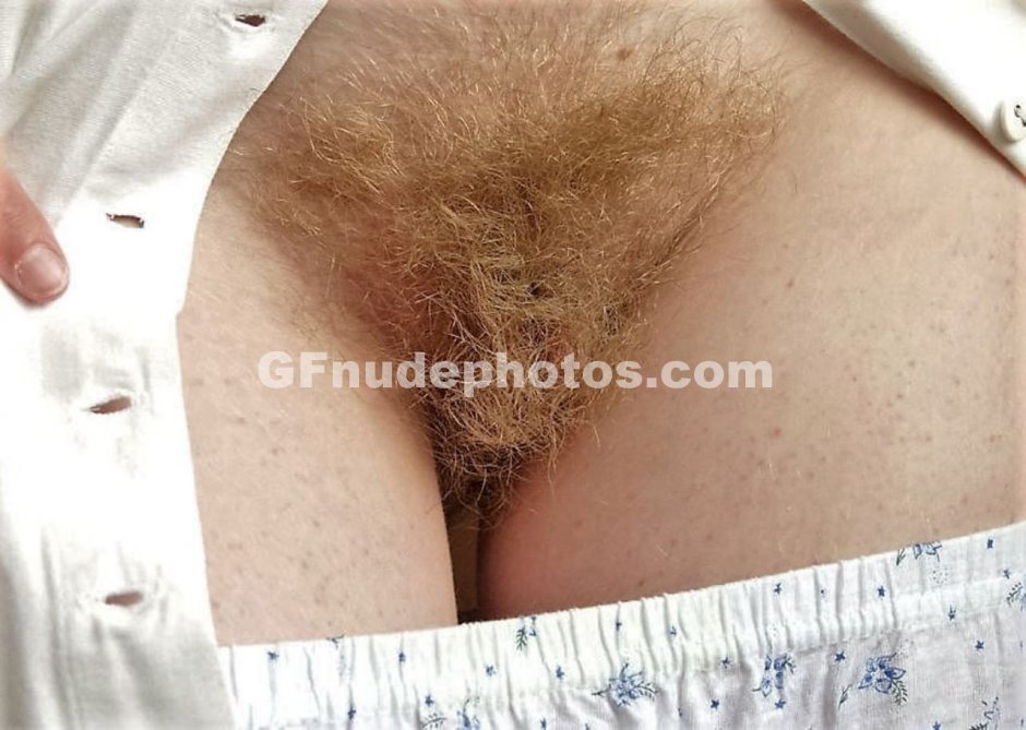 Лобковые волосы