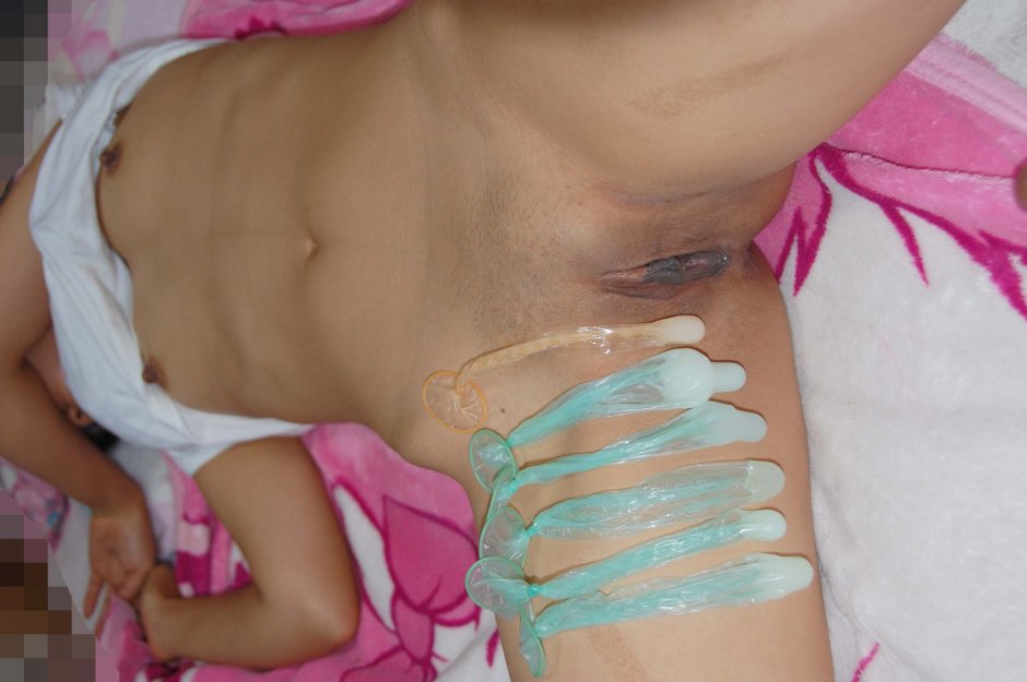 Женский спризирвативи