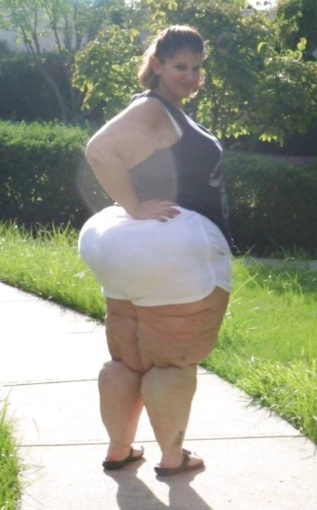 Fat cellulite thighs