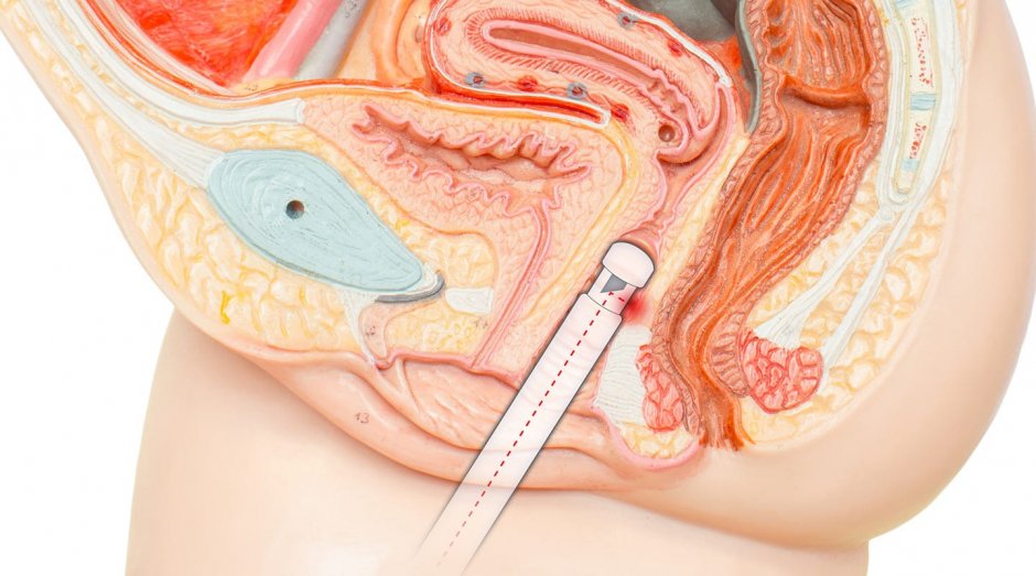 Разрез женского таза топографическая анатомия
