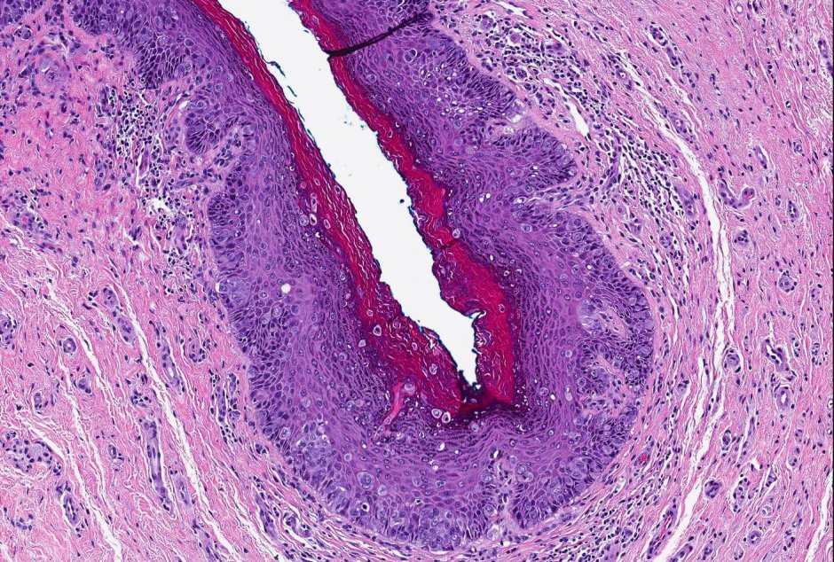 Органы малого таза у мужчин