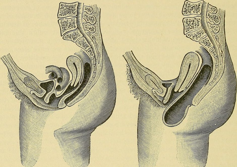 Фото гениталий крупным планом