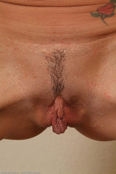 Loose labia