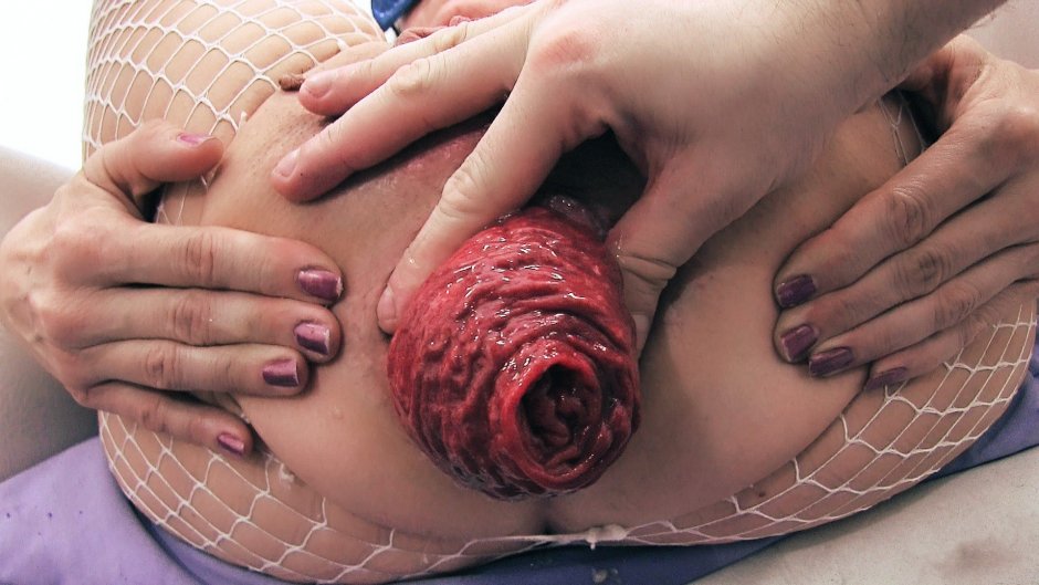 Анальный фистинг розочки