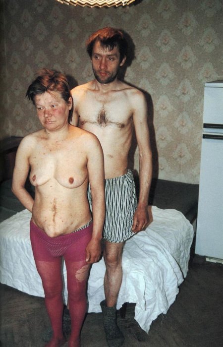 Naked homeless women