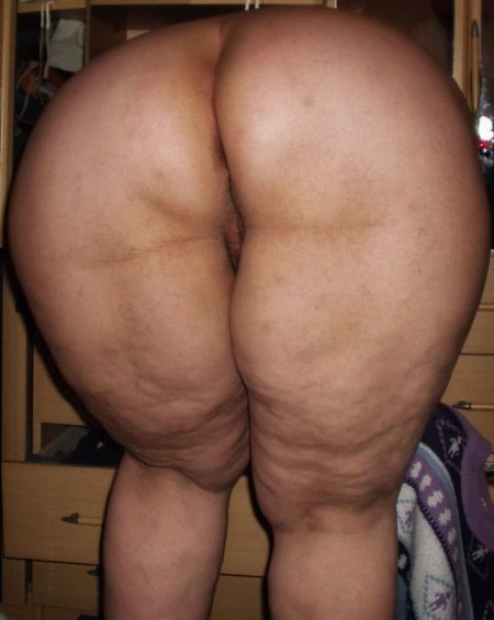 Cellulite butts of women
