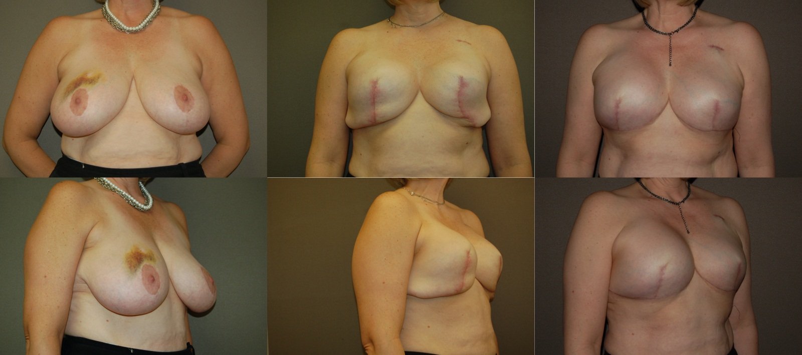 от секса увеличивается грудь у женщин фото 119