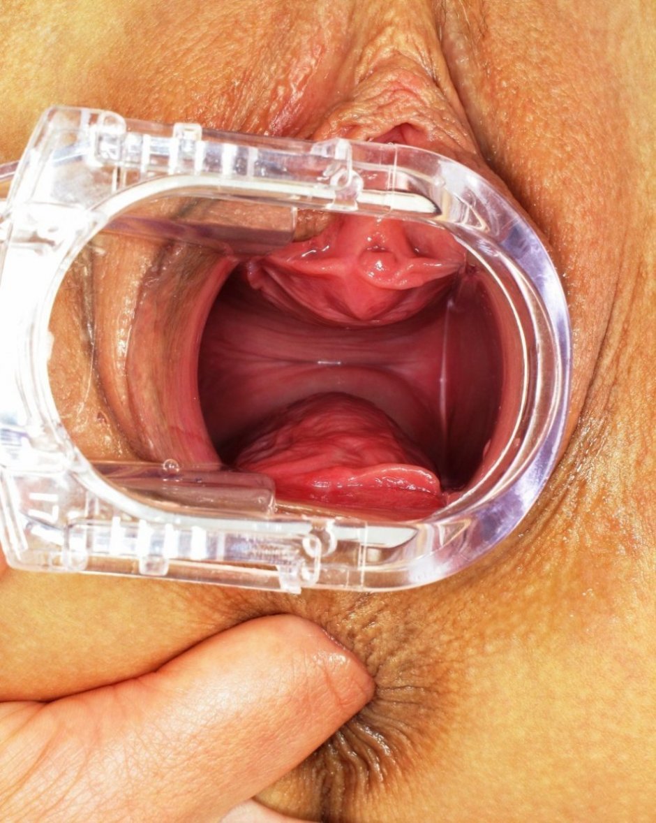 Вагинальный расширитель внутри