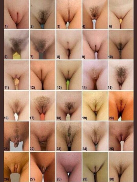 High position of the clitoris