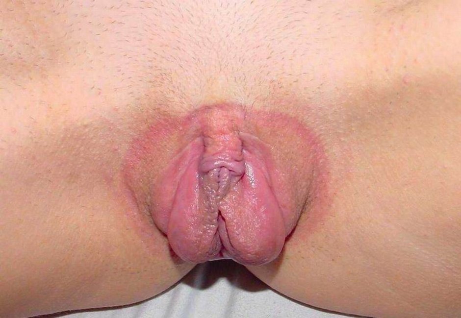 Самая некрасивая вагина