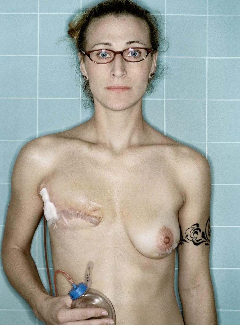 Голые страшные женщины карлики