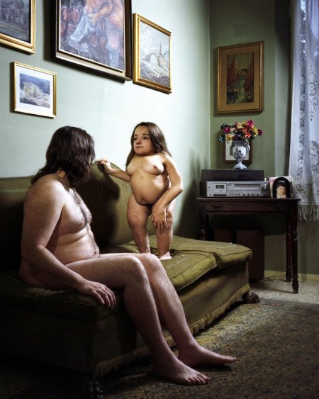 Women with amputees naked