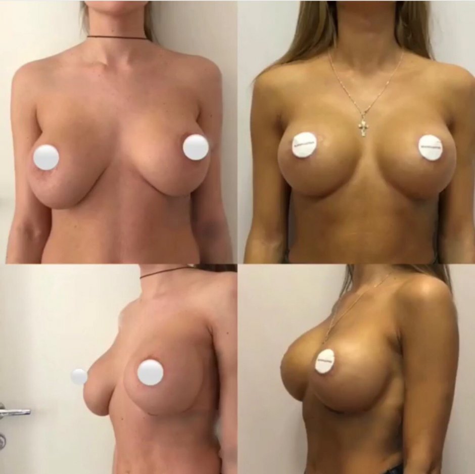 Силиконовая грудь с пирсингом
