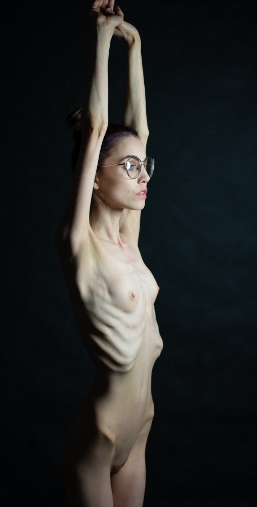 Анорексички голые девушки анорексия ▶️ 2000 лучших xXx роликов по искомому запросу