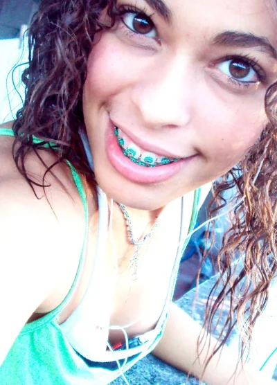 Милена Безбородова брекеты