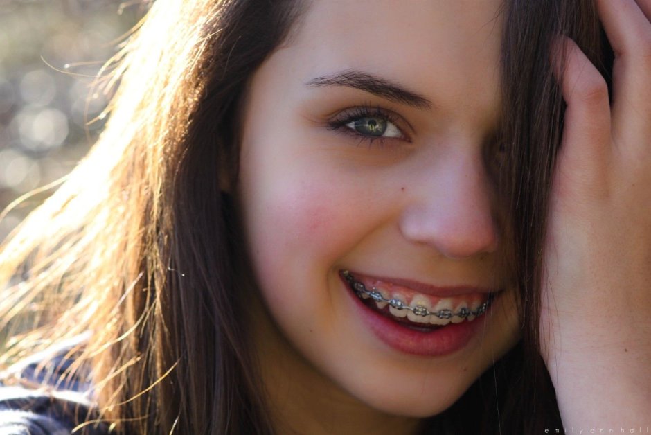 Брекеты фон