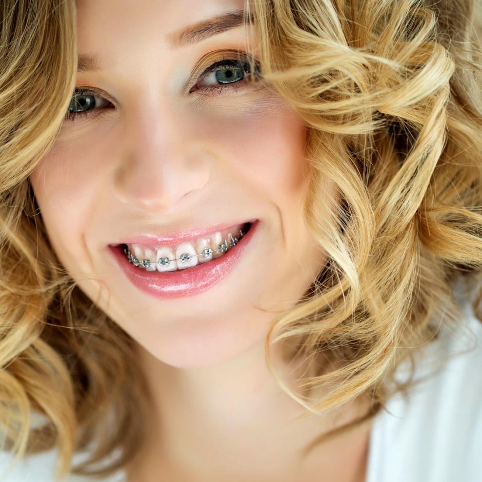 Девушка с кривыми зубами