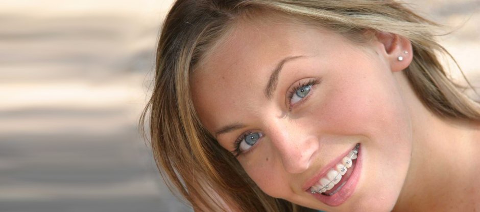 Голые девочки с брекетами