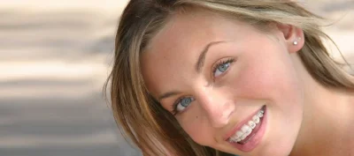 Голые девочки с брекетами