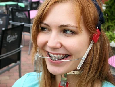 Девушки с брекетами 2021