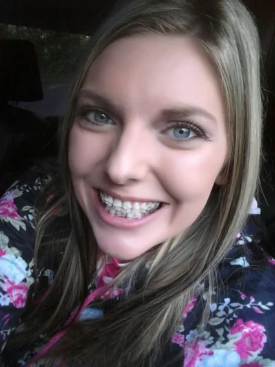 Милые девушки с брекетами